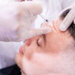 Things To Know Before Getting Botox